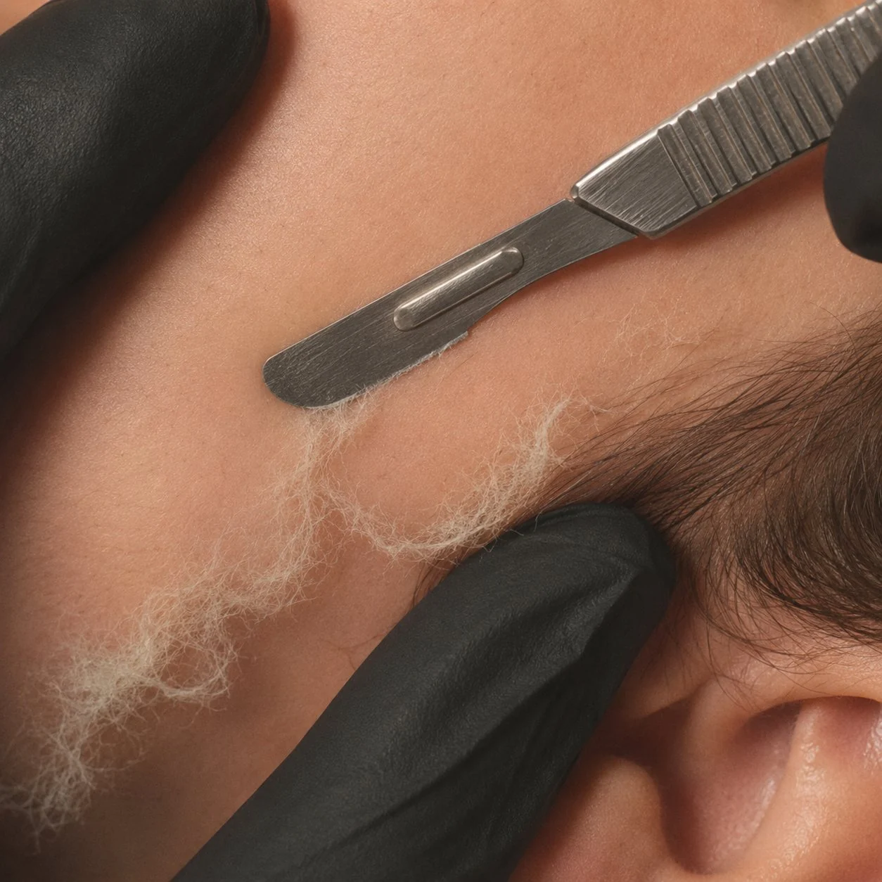 Professional dermaplaning close-up