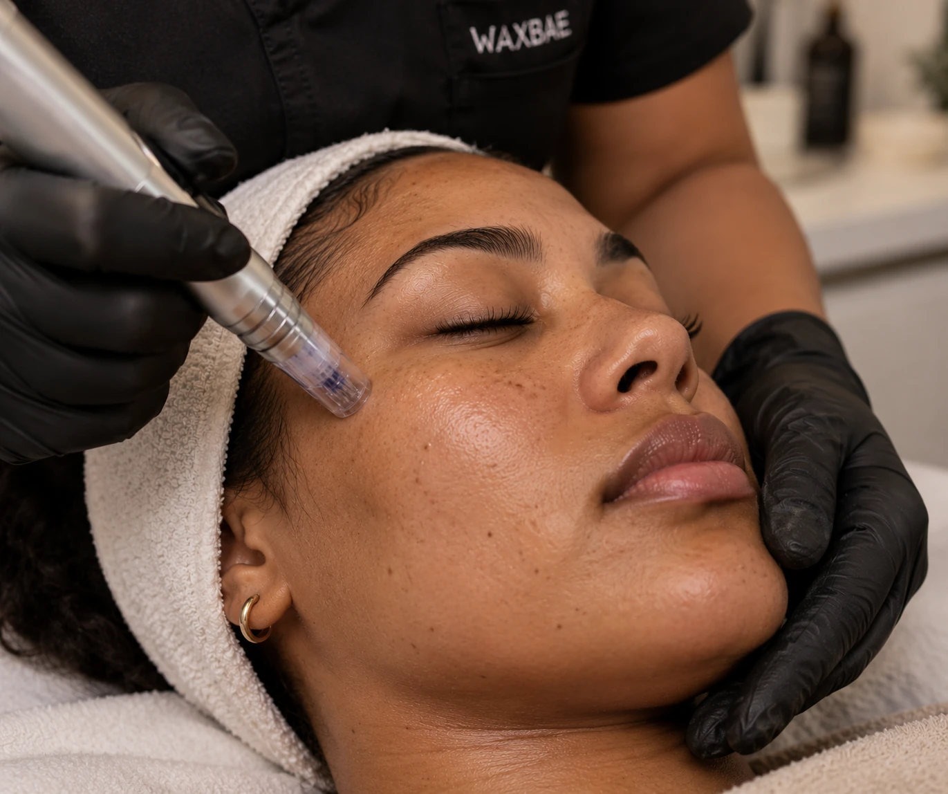 A client receiving a microneedling facial treatment